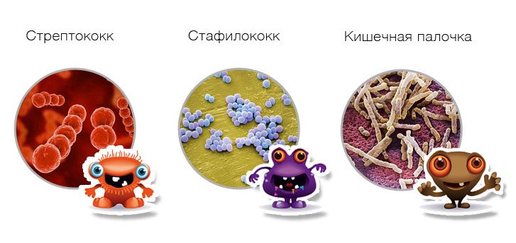 Болит спина справа от крестца